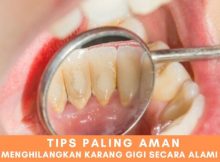 menghilangkan karang gigi secara alami